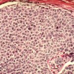 Gilead and Roche Bet on Protein Degraders for Their Cancer Drug Pipelines