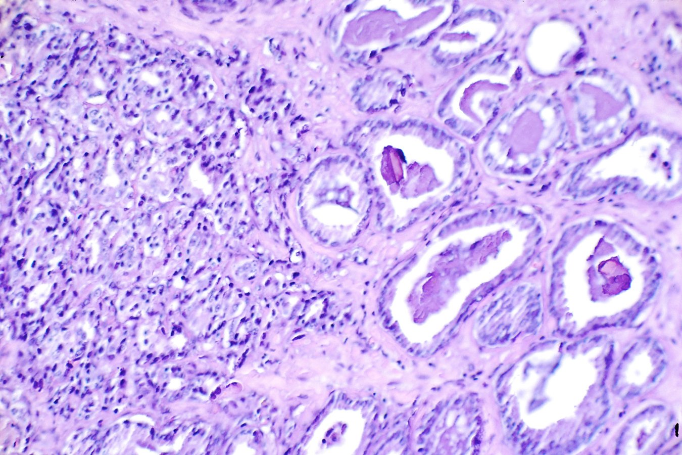 New Cancer Biotech Unveils M for Dual-Targeting Prostate Cancer Drug