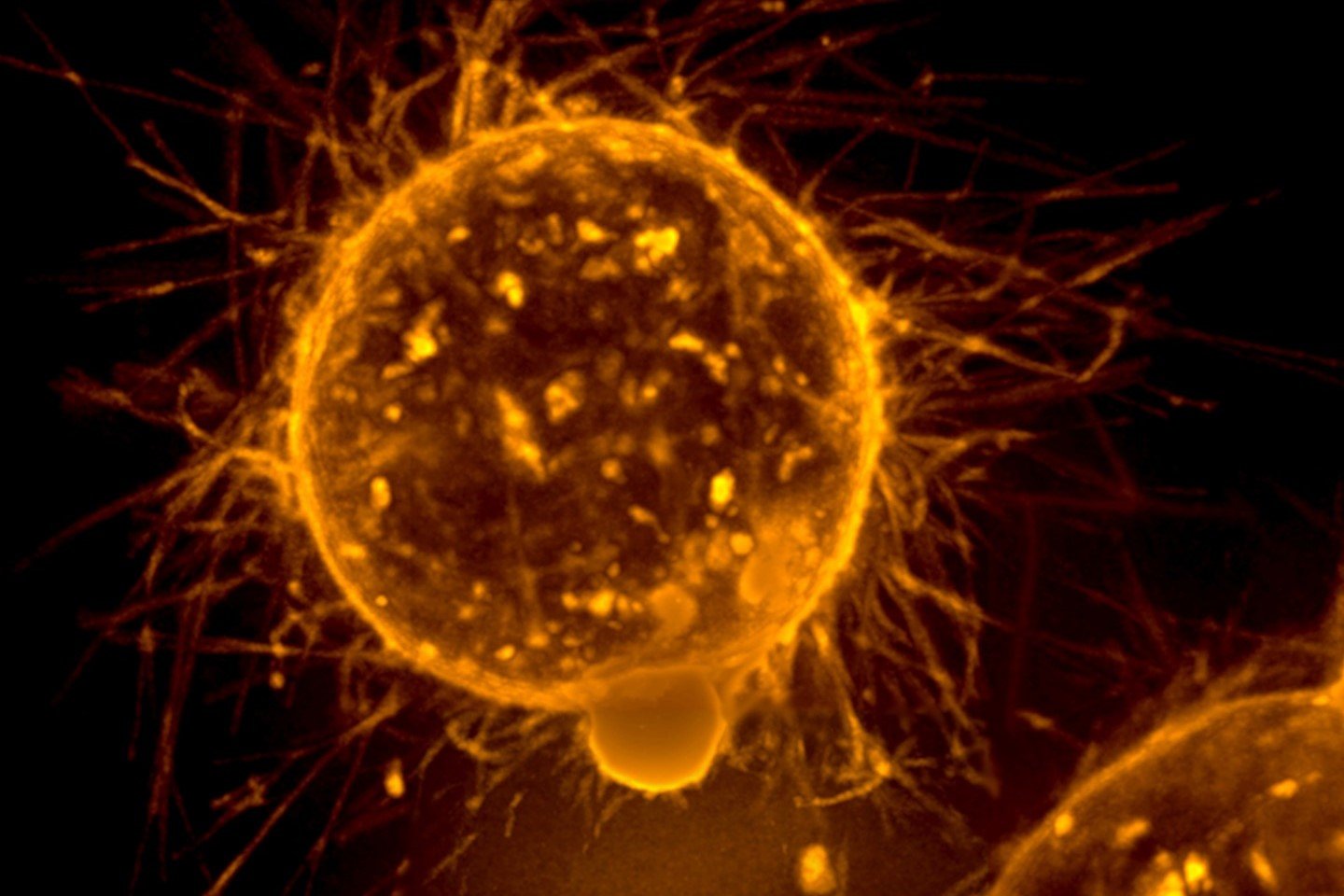 Startup Secures M to Take On One of the Challenges for ADCs in Breast Cancer